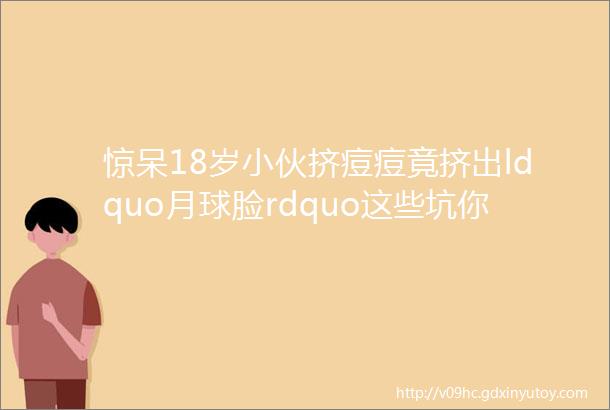 惊呆18岁小伙挤痘痘竟挤出ldquo月球脸rdquo这些坑你有没有踩过